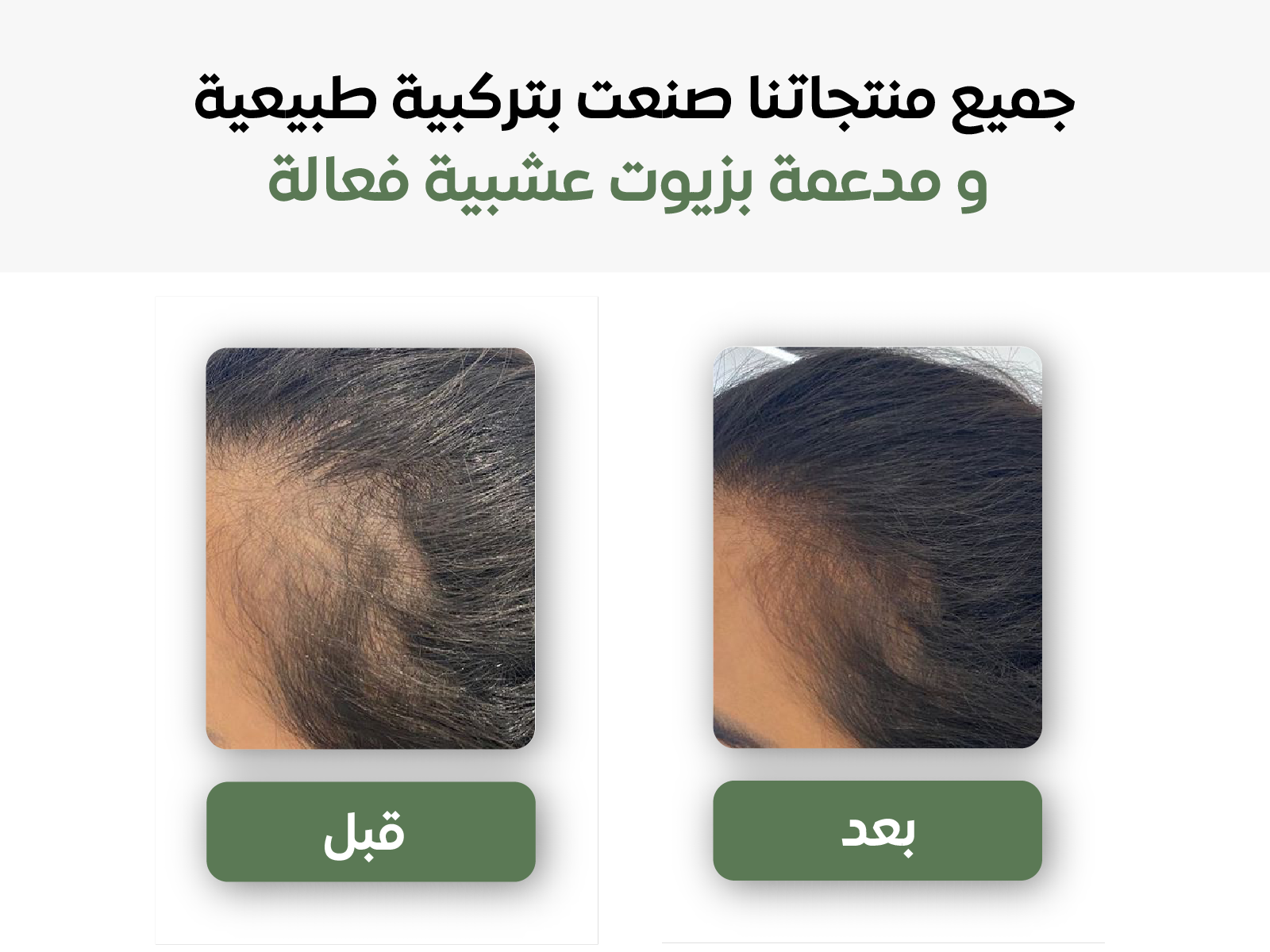 ماسك الشعر السدر و الافوكادو